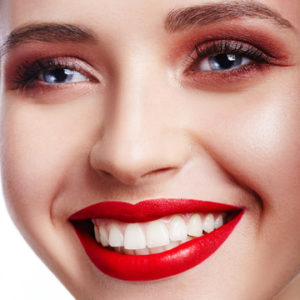 questions about dental veneers